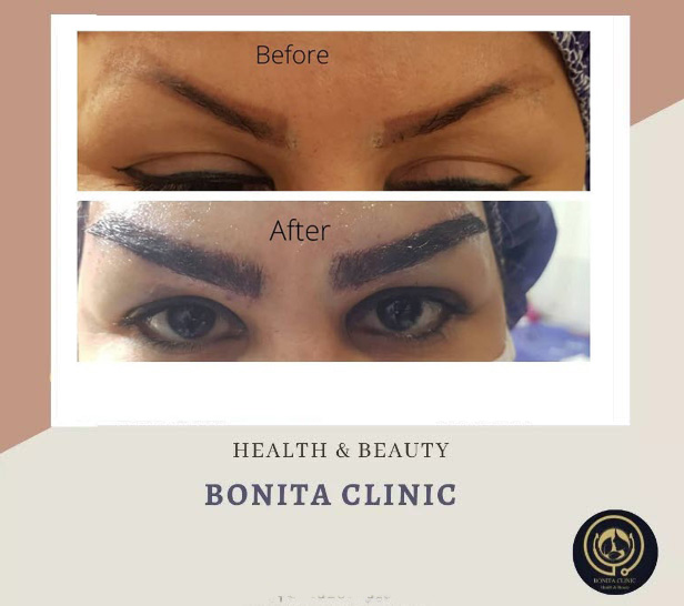 Hair-services-clinicbonita (4) کاشت ابرو توسط پزشک متخصص | کلینیک بنیتا اصفهان