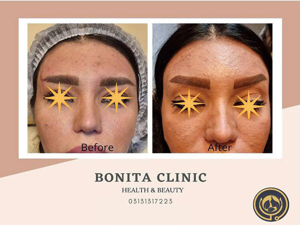 skin-services-clinicbonita (2) بهترین کلینیک زیبایی در استان اصفهان | کلینیک بنیتا
