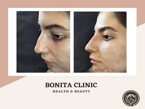 skin-services-clinicbonita (4) برطرف کردن تیرگی های پوست | کلینیک بنیتا