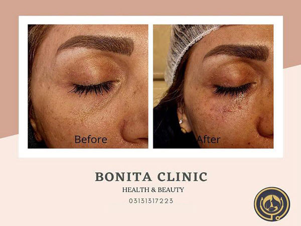 skin-services-clinicbonita (5) درمان مشکلات پوستی با بهترین قیمت | کلینیک بنیتا