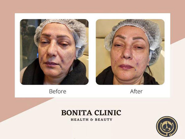 skin-services-clinicbonita (7) ارائه خدمات زیبایی با قیمت مناسب | کلینیک