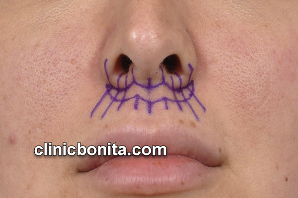 سانترال لب | کلینیک بنیتای اصفهان