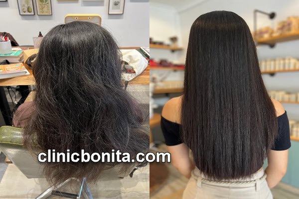 تقویت مو | کلینیک بنیتای اصفهان