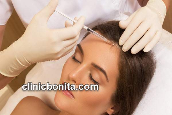 فیلر مو | کلینیک بنیتای اصفهان