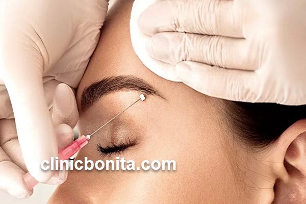 لیفت ابرو با نخ | کلینیک بنیتای اصفهان