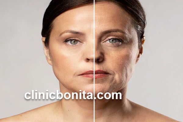 لیفت شقیقه | کلینیک بنیتای اصفهان