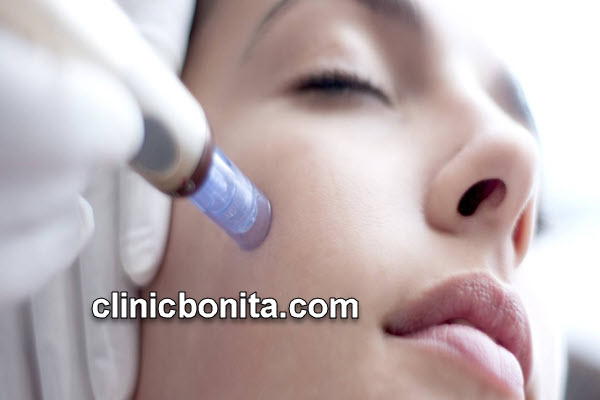 مزوتراپ | کلینیک بنیتای اصفهان