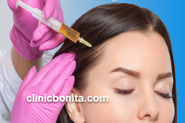 پی آر پی مو (PRP) | کلینیک بنیتای اصفهان