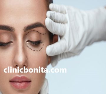 کلینیک تخصصی بلفاروپلاستی در اصفهان | کلینیک بنیتای اصفهان