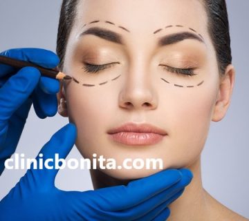 بهترین پزشک جراحی بلفاروپلاستی در اصفهان | کلینیک بنیتای اصفهان