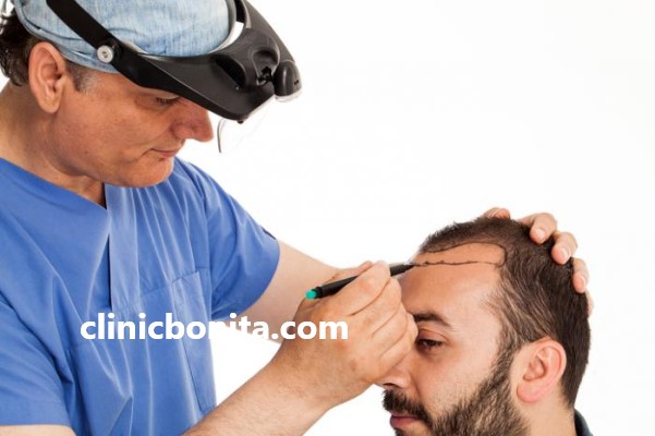 بهترین مرکز کاشت مو در اصفهان | کلینیک بنیتای اصفهان