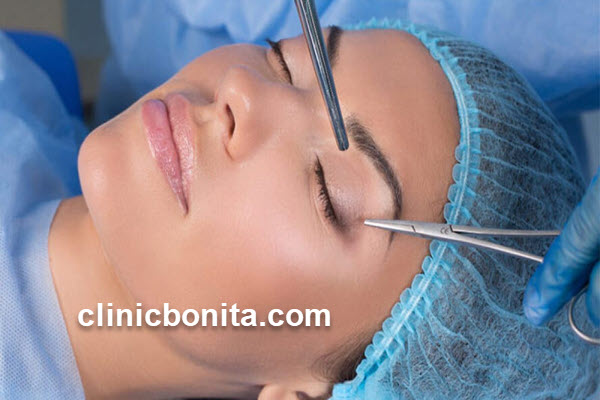 بلفاروپلاستی | کلینیک بنیتای اصفهان