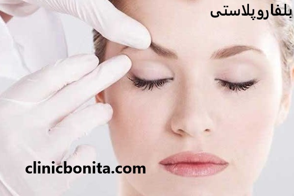 بلفاروپلاستی با بهترین کیفیت و قیمت مناسب در کلینیک بنیتای اصفهان