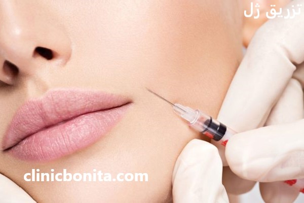 تزریق ژل در بهترین کلینیک اصفهان - کلینیک بنیتای اصفهان