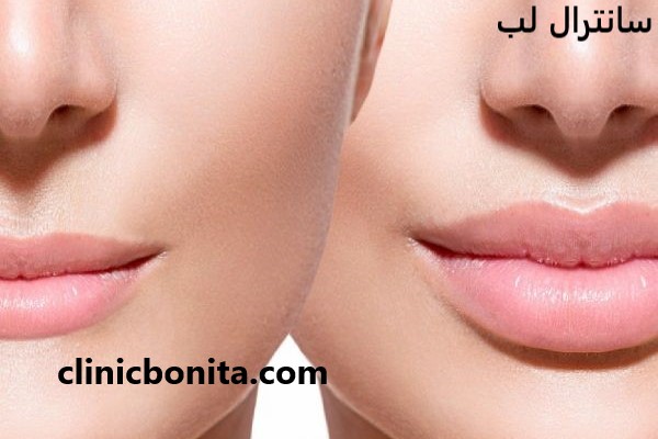 سانترال لب در بهترین کلینیک اصفهان - کلینیک بنیتای اصفهان