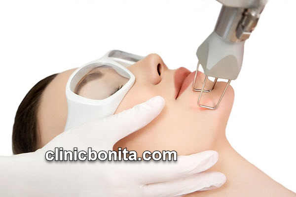 لیزر co2 فرکشنال | کلینیک بنیتای اصفهان