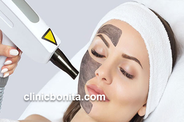 لیزر کیوسوئیچ | کلینیک بنیتای اصفهان