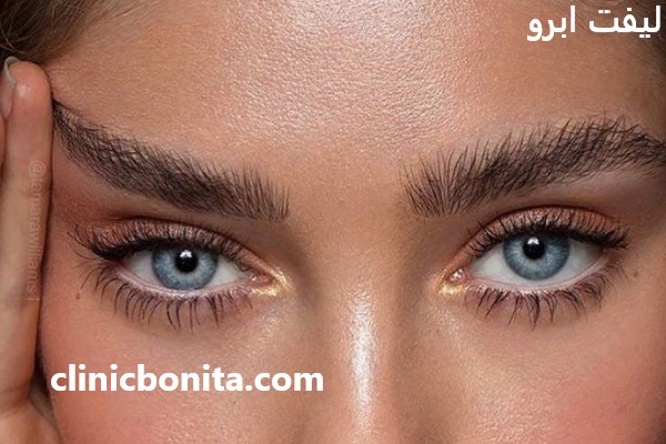 بهترین کلینیک برای لیفت ابرو در اصفهان - کلینیک بنیتای اصفهان