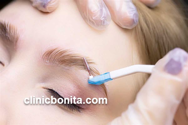 لیفت ابرو | کلینیک بنیتای اصفهان