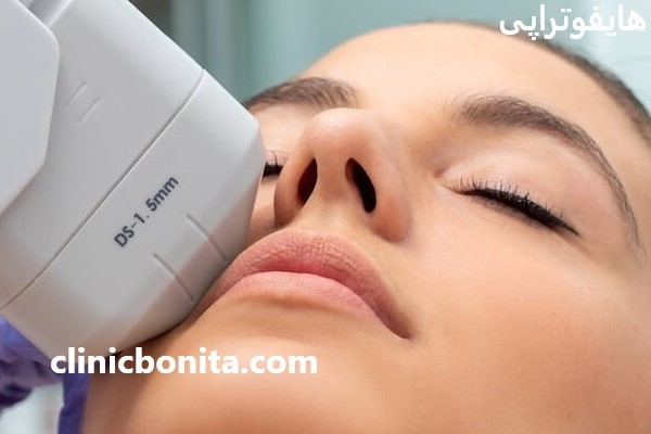 ارائه خدمات هایفوتراپی با بهترین قیمت در کلینیک بنیتای اصفهان