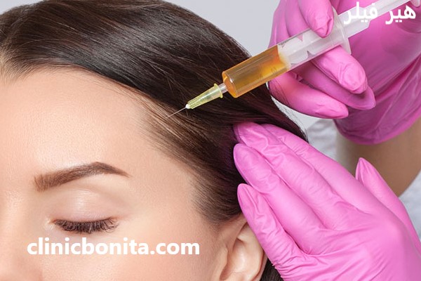 هیر فیلر با تخفیف ویژه در کلینیک بنیتای اصفهان