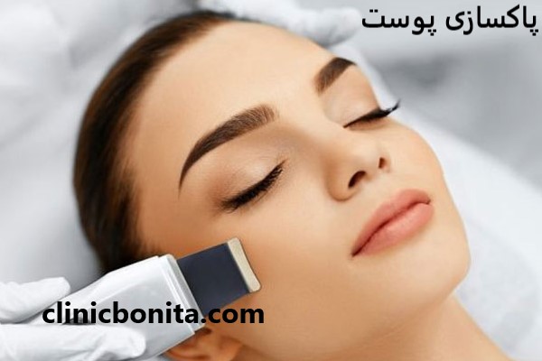 پاکسازی پوست با قیمت مناسب در کلینیک بنیتای اصفهان