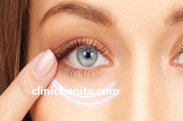 بهترین تایم برای عمل بلفارپلاستی پلک | کلینیک بنیتای اصفهان