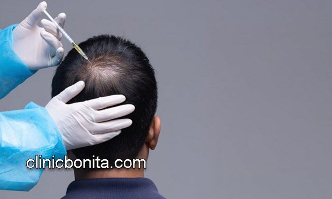 آشنایی با 10 تا از مراقبت های بعد از کاشت مو | کلینیک بنیتای اصفهان