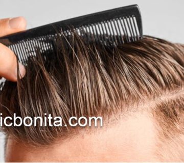 هزینه های کاشت مو بدون جراحی در اصفهان | کلینیک بنیتای اصفهان