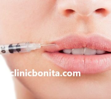 بهترین دکتر برای تزریق ژل لب در اصفهان | کلینیک بنیتای اصفهان
