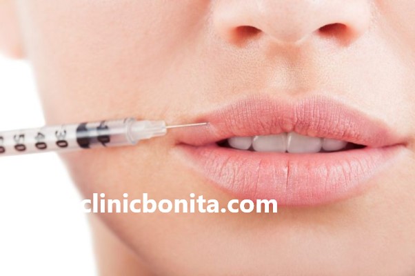بهترین دکتر برای تزریق ژل لب در اصفهان | کلینیک بنیتای اصفهان