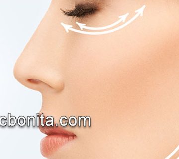 بهترین روش لیفتینگ صورت با قیمت مناسب در کلینیک تخصصی | کلینیک بنیتای اصفهان