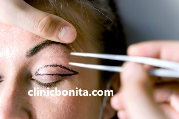 انواع عمل بلفاروپلاستی در اصفهان | کلینیک بنیتای اصفهان