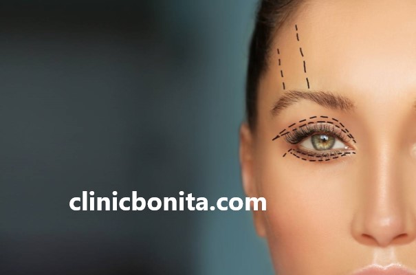 عمل بلفاروپلاستی برای چه سنی مناسب است؟ | کلینیک بنیتای اصفهان