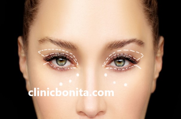 رفع چروک پوست در پیری با بلفاروپلاستی | کلینیک بنیتای اصفهان