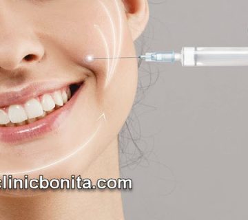 مراقبت های بعد از تزریق ژل خط خنده | کلینیک بنیتای اصفهان