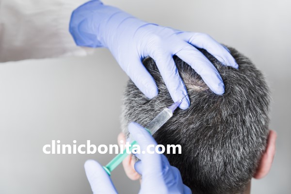 مزایای مزوتراپی از کات مو سر | کلینیک بنیتا اصفهان