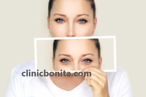 پزشک متخصص جراحی بلفاروپلاستی در اصفهان | کلینیک بنیتای اصفهان