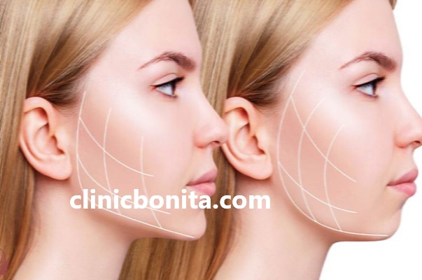 رفع غبغب و زاویه سازی فک با هایفوتراپی در اصفهان | کلینیک بنیتای اصفهان