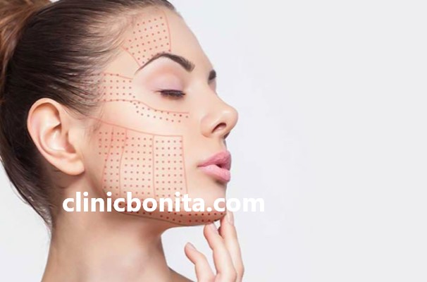 هایفوتراپی غبغب با حداقل هزینه ها | کلینیک بنیتای اصفهان