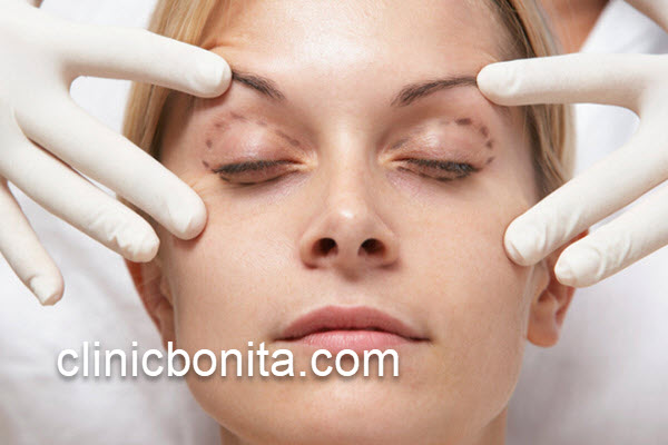 اطلاع از مراقبت های پس از عمل جراحی بلفاروپلاستی پلک بالا | کلینیک بنیتای اصفهان