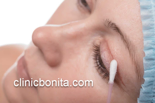 اقدامات پس از جراحی بلفاروپلاستی پلک بالا در اصفهان | کلینیک بنیتای اصفهان