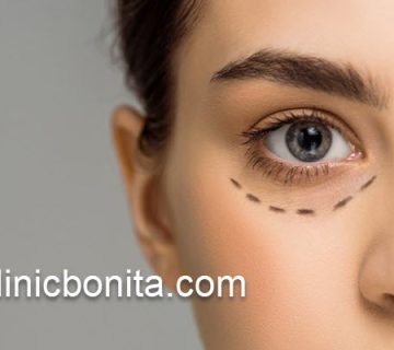 اقدامات پس از جراحی بلفاروپلاستی پلک پایین | کلینیک بنیتای اصفهان