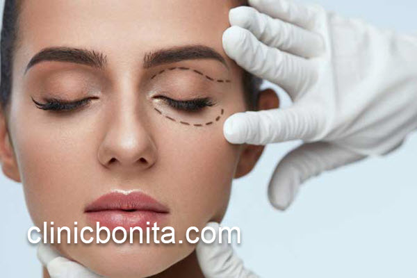 مراقبت های پس از بلفاروپلاستی پلک پایین | کلینیک بنیتای اصفهان