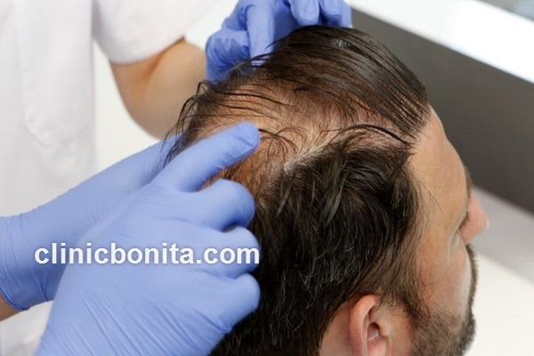 کاندیدای نامناسب برای کاشت مو | کلینیک بنیتای اصفهان