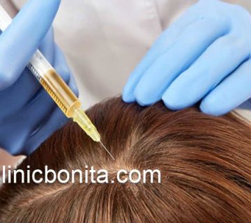 نکات مهم پس از هیر فیلر مو | کلینیک بنیتای اصفهان