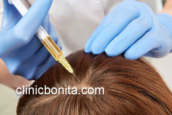 نکات مهم پس از هیر فیلر مو | کلینیک بنیتای اصفهان