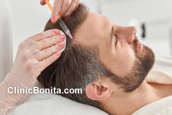 قیمت کاشت هر تار مو چقدر است؟ | کلینیک بنیتای اصفهان