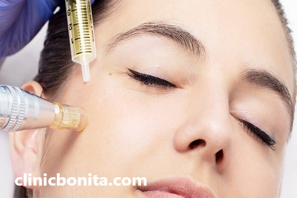 مزوتراپی توسط بهترین دکتر در اصفهان | کلینیک بنیتای اصفهان