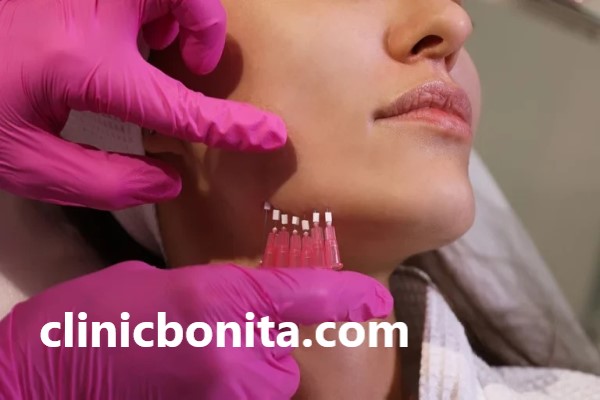 بهترین کلینیک لیفت غبغب با نخ در اصفهان | کلینیک بنیتا